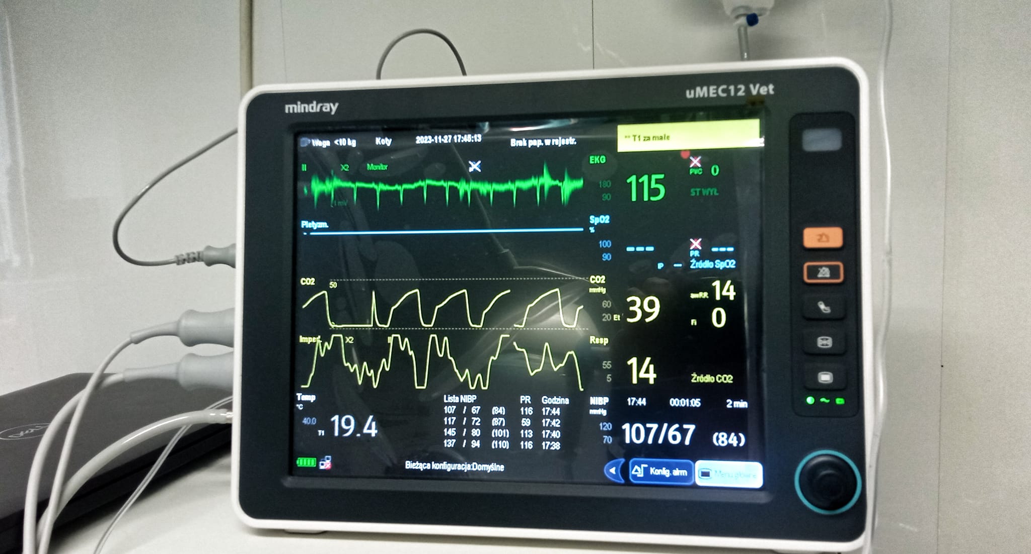 ekg